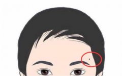 男性眉毛上的痣  好事还是坏事